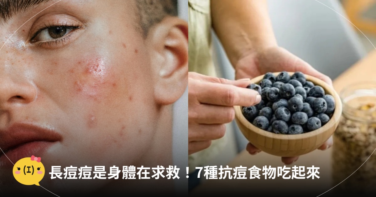 長痘痘是身體在求救,7種抗痘食物,圖片來源:unsplash