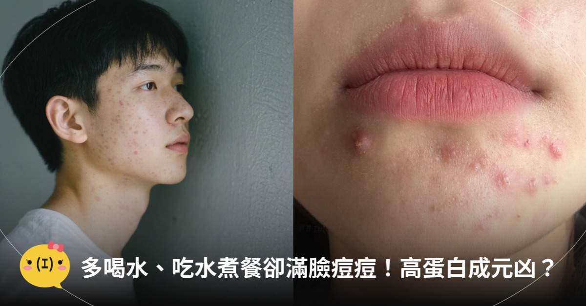 多喝水、吃水煮餐卻滿臉痘痘!高蛋白成元凶?圖片來源:doubao、小紅書