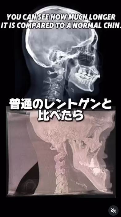 螢幕擷取畫面_6-7-2025_132628_www.instagram.com