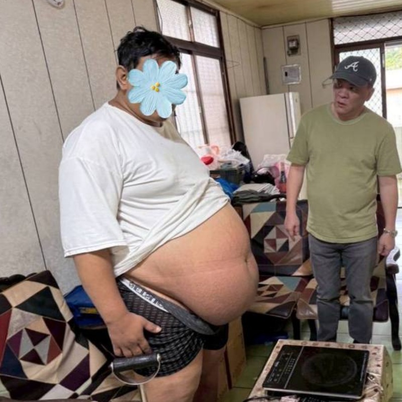 只求撐到孩子18歲！肝硬化單親爸挺巨肚找工作，兒常半夜伸手摸鼻息「怕他不在了」