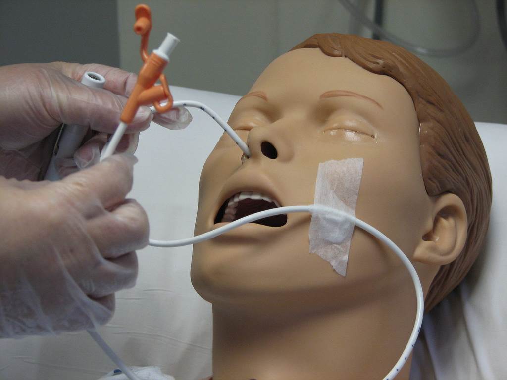 Nasogastric tube