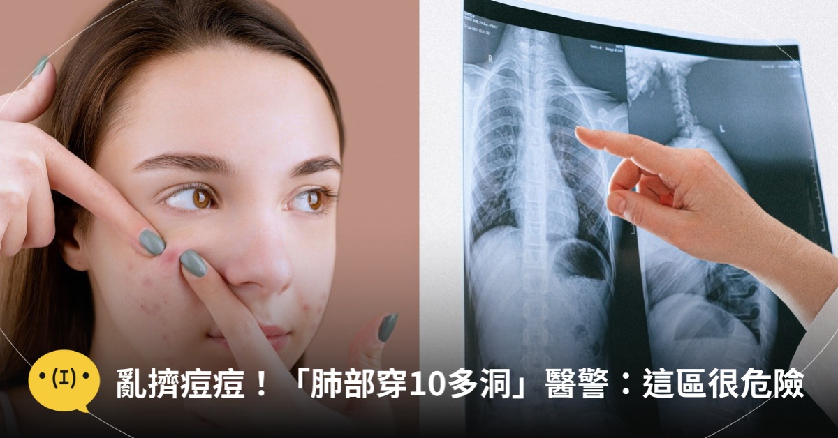 圖片來源：pexels（示意圖）