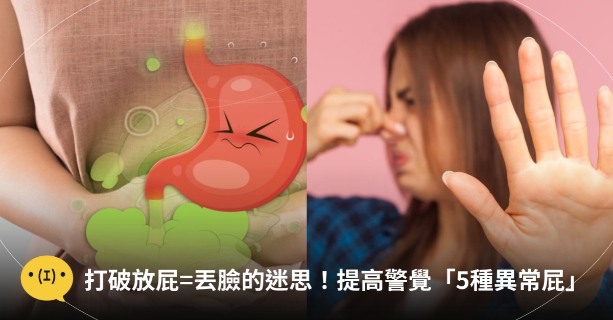 圖片來源：pexels