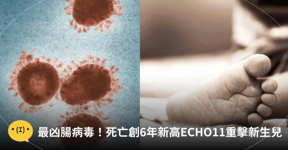 圖片來源：pexels（示意圖）