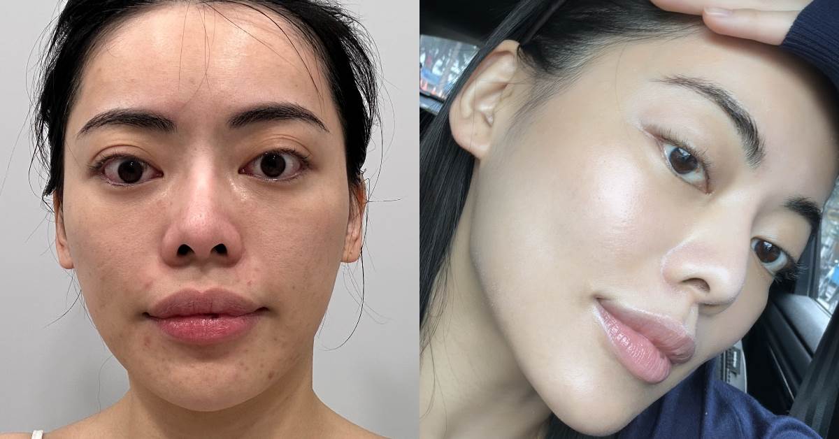 FotoJet - 2025-12-10T114512.805