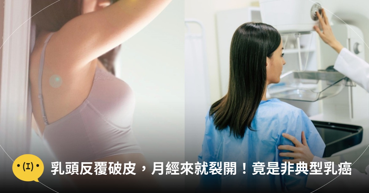 圖片來源：pexels