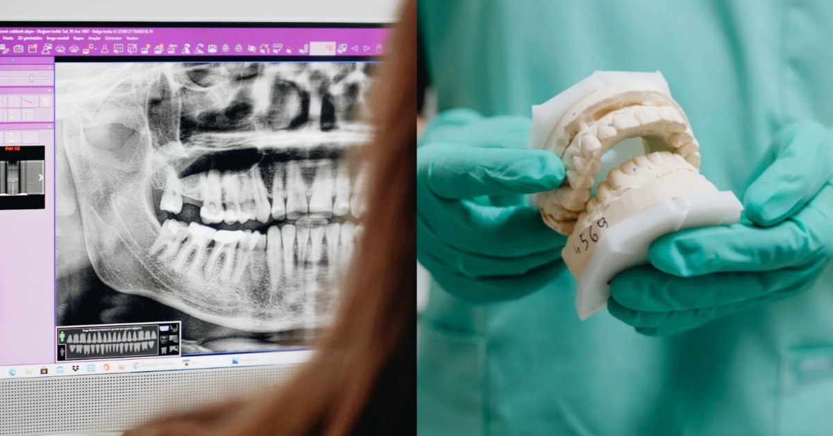 圖片來源：pexels（示意圖）