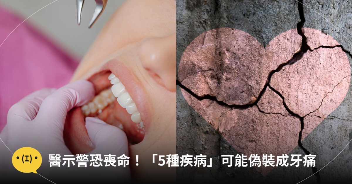 圖片來源：pexels