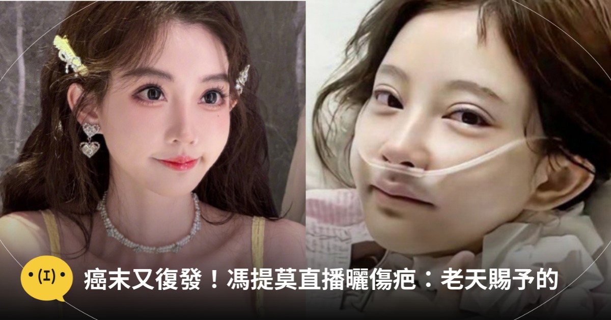 圖片來源：微博＠馮提莫