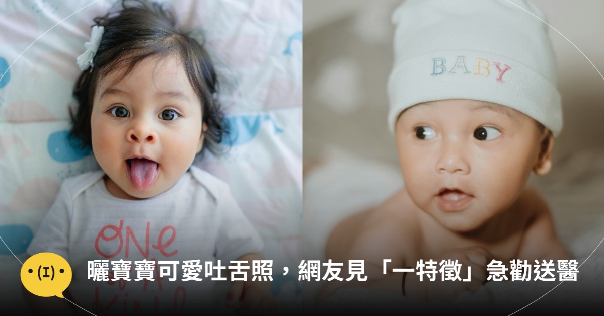 曬寶寶可愛吐舌照，網友見「一特徵」急勸送醫！圖片來源：unsplash