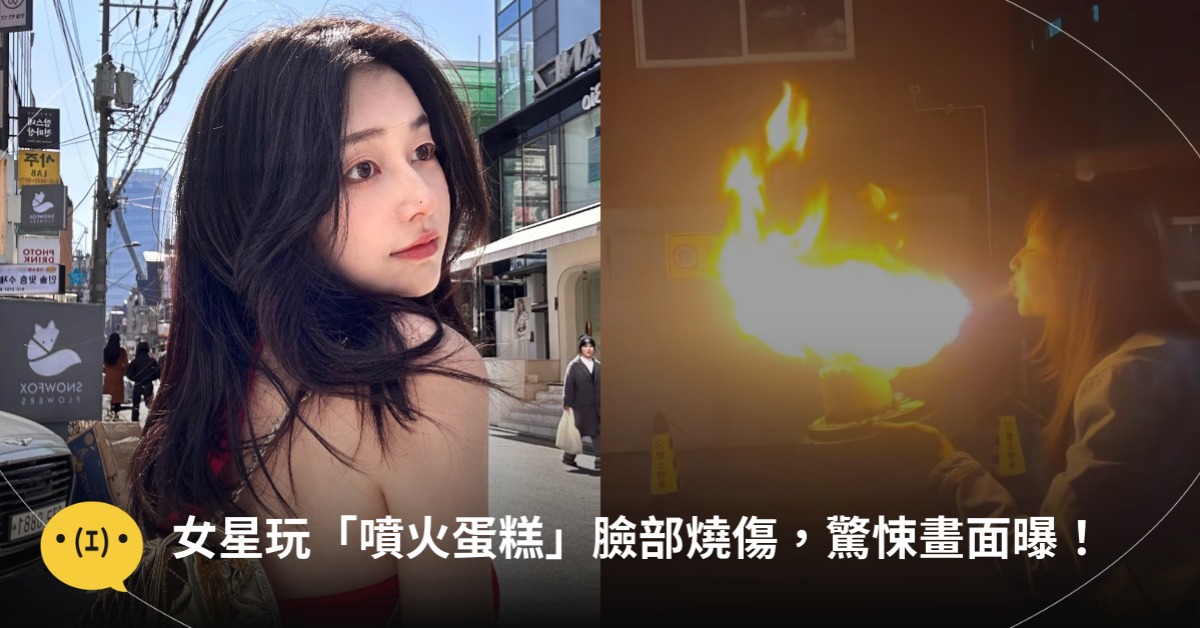 女星玩「噴火蛋糕」臉部燒傷，驚悚畫面曝，圖片來源：王添羽