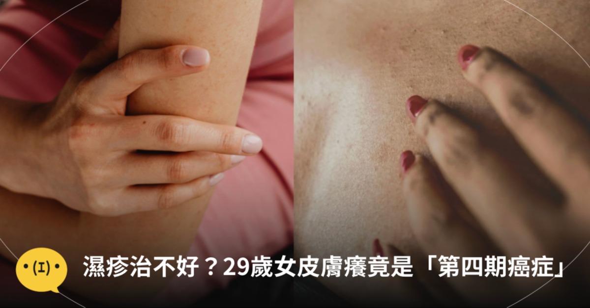 圖片來源：pexels（示意圖）