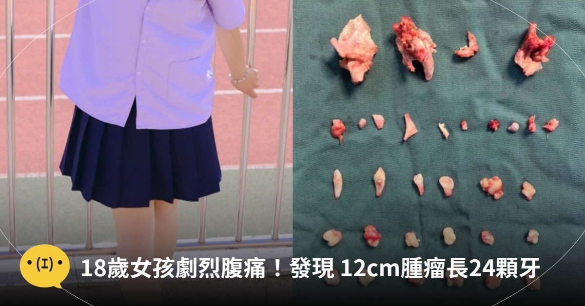 圖片來源：示意圖／pexels、微博