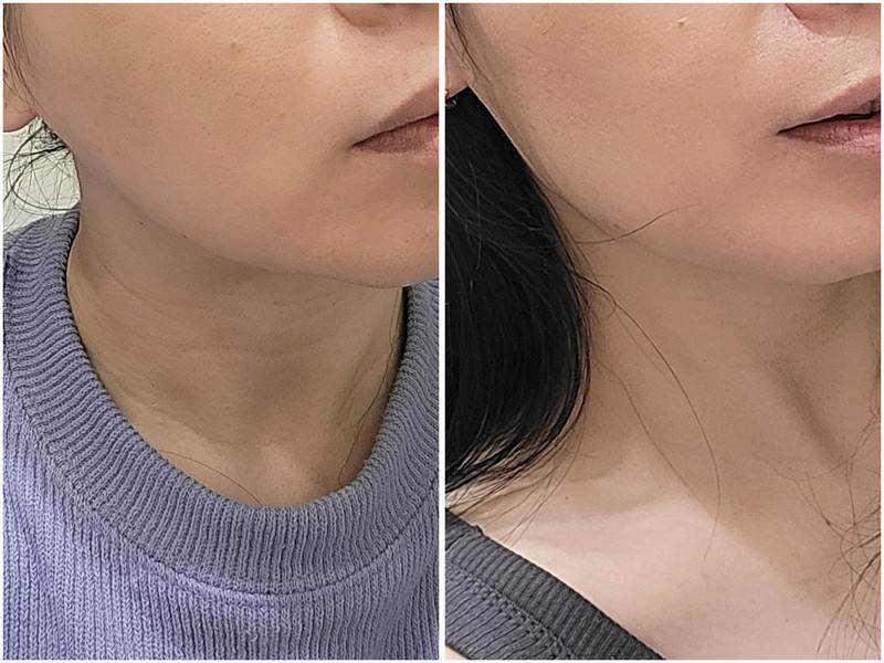 圖片來源：痞客邦 碗桂伸展台