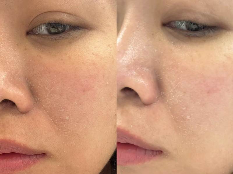 圖片來源：痞客邦 假鼻子姐姐