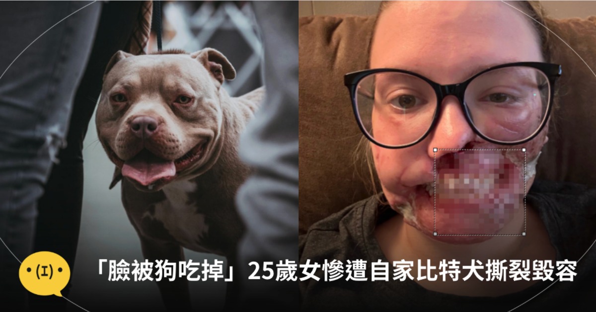 圖片來源：pexels（示意圖）gofundme