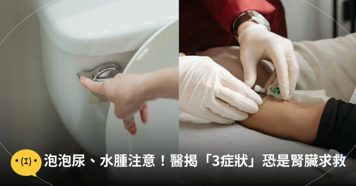 圖片來源：pexels（示意圖）