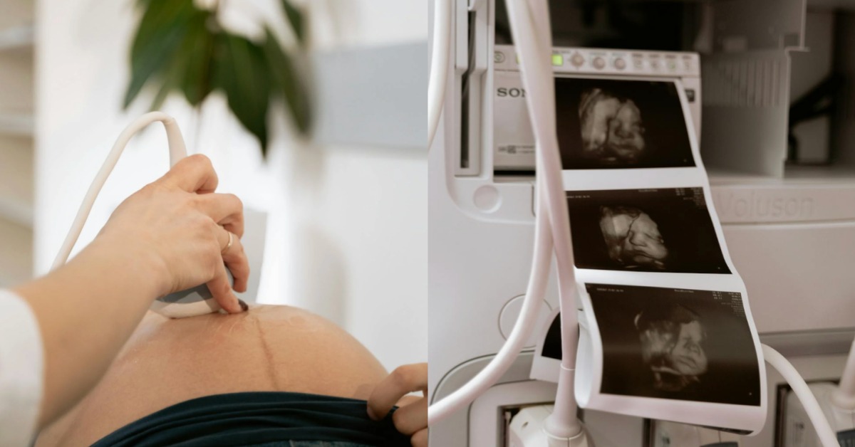 圖片來源：pexels（示意圖）