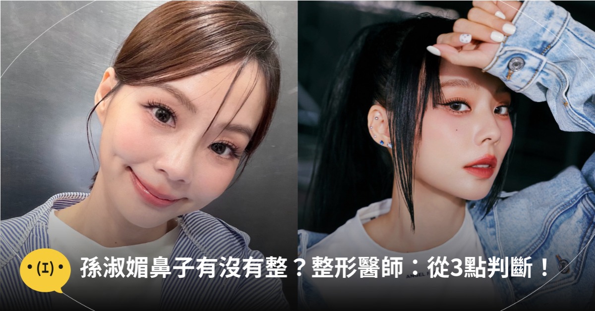 孫淑媚鼻子有沒有整？整形醫師：從3點判斷，圖片來源：FB@孫淑媚