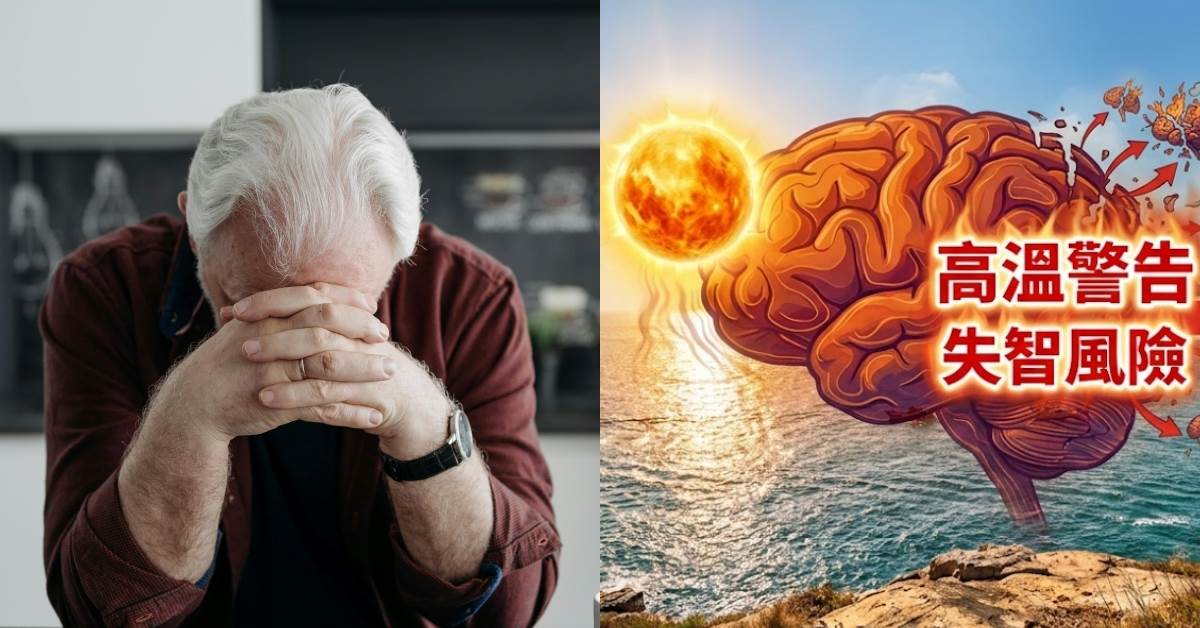 研究揭曾發生熱傷害者，未來罹患失智症的風險比一般人高。圖片來源：AI生成