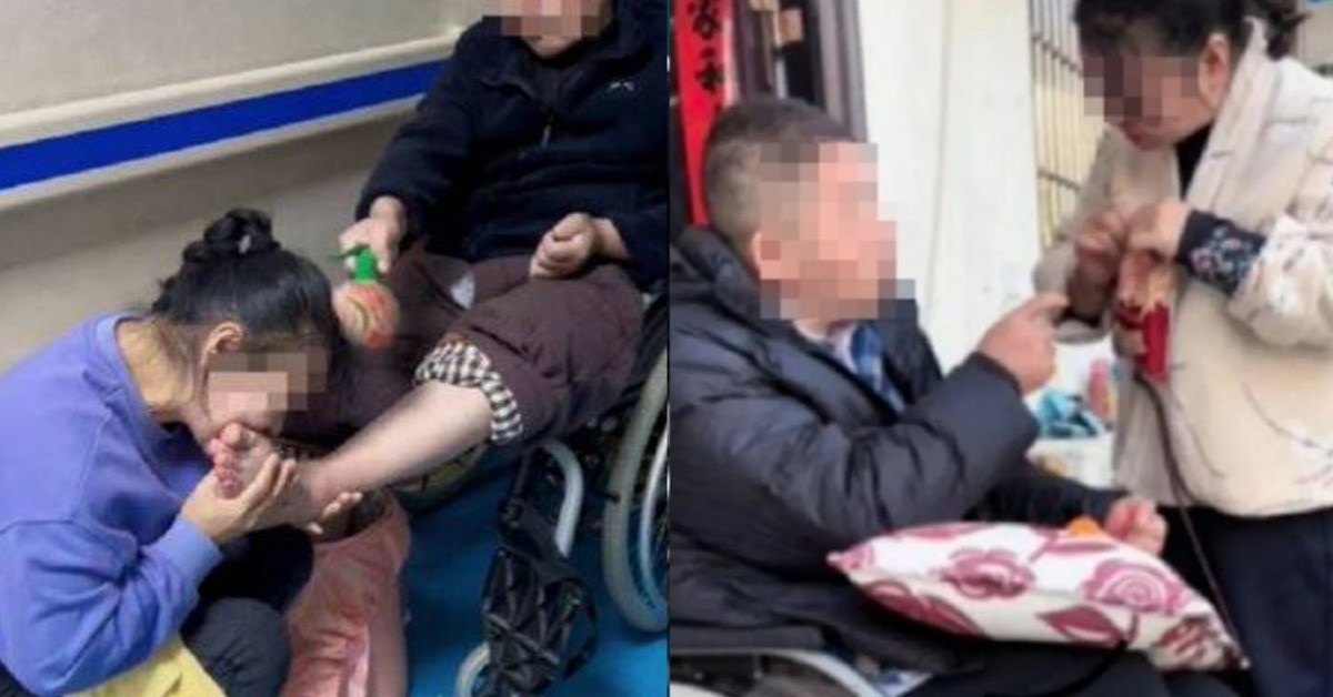 植物人男子昏迷7年後，在妻子「咬腳趾」刺激下奇蹟般甦醒。圖片來源：weibo