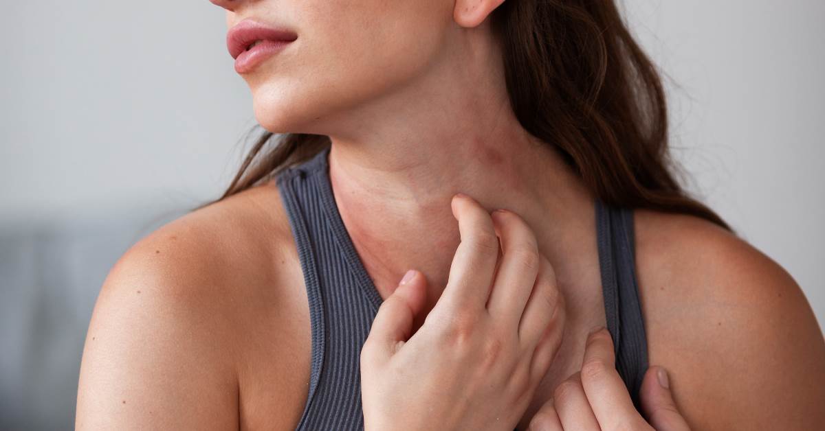 濕疹發作怎麼辦？中醫師：金銀花煮水濕敷
圖片來源：eczema