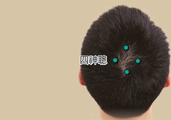 「四神聰」在頭部，百會前、後、左、右各旁開1寸（大拇指橫寬），共4 穴。（圖片／三采文化提供）